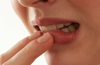 Regelmäßige Prophylaxe beugt Mundgeruch vor