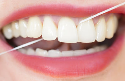 Zahnseide dient zur Reinigung der Zahnzwischenräume von Bakterien.